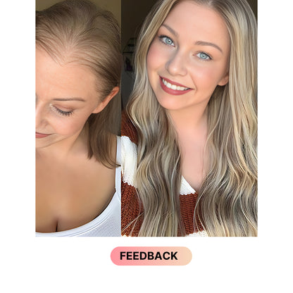 White Blonde Balayage Wig | 100% Vietnamese Hair | Feathered Hair, the Ultra-Realistic Scalp Wig, Skillfully Handcrafted for longevity